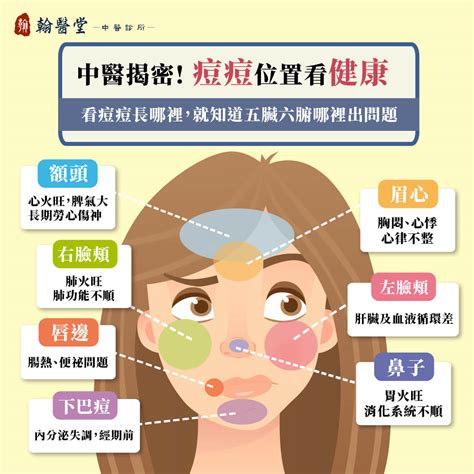 痘痘長眉毛|「痘痘位置」反映身體健康？告訴你下巴、額頭、鼻子。